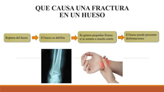 QUE CAUSA UNA FRACTURA
EN UN HUESO
Ruptura del hueso
El hueso puede presentar
deformaciones
Se genera pequeñas fisuras
si se somete a mucho estrés
El hueso se debilita
 
