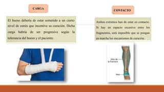 El hueso debería de estar sometido a un cierto
nivel de estrés que incentive su curación. Dicha
carga habría de ser progresiva según la
tolerancia del hueso y el paciente.
Ambos extremos han de estar en contacto.
Si hay un espacio excesivo entre los
fragmentos, será imposible que se pongan
en marcha los mecanismos de curación.
CONTACTO
CARGA
 
