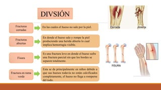 DIVSIÓN
Fracturas
cerradas
En las cuales el hueso no sale por la piel.
Fracturas
abiertas
En donde el hueso sale y rompe la piel
produciendo una herida abierta lo cual
implica hemorragia visible.
Fisura
Es una fractura leve en donde el hueso sufre
una fractura parcial sin que los bordes se
separen totalmente.
Fractura en rama
verde
Esta se da principalmente en niños debido a
que sus huesos todavía no están calcificados
completamente, el hueso no llega a romperse
del todo.
 