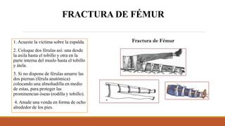 FRACTURA DE FÉMUR
1. Acueste la víctima sobre la espalda.
2. Coloque dos férulas así: una desde
la axila hasta el tobillo y otra en la
parte interna del muslo hasta el tobillo
y átela.
3. Si no dispone de férulas amarre las
dos piernas (férula anatómica)
colocando una almohadilla en medio
de estas, para proteger las
prominencias óseas (rodilla y tobillo).
4. Anude una venda en forma de ocho
alrededor de los pies.
 