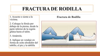 FRACTURA DE RODILLA
1. Acueste o siente a la
víctima.
2. Coloque la férula por
debajo de la pierna, desde la
parte inferior de la región
glútea hasta el talón.
3. Amárrela.
4. Aplique un vendaje en
forma de ocho alrededor del
tobillo, el pie y la tablilla
 
