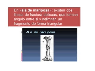 En «ala de mariposa»: existen dos
líneas de fractura oblicuas, que forman
ángulo entre si y delimitan un
fragmento de forma triangular
 