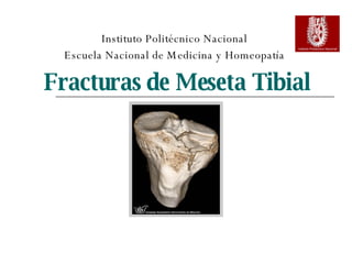 Fracturas de Meseta Tibial Instituto Politécnico Nacional Escuela Nacional de Medicina y Homeopatía 
