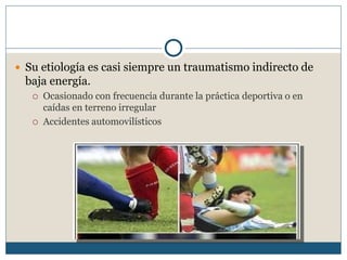  Su etiología es casi siempre un traumatismo indirecto de
baja energía.
 Ocasionado con frecuencia durante la práctica deportiva o en
caídas en terreno irregular
 Accidentes automovilísticos
 