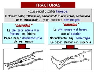 FRACTURAS
                   Rotura parcial o total de huesos.
Síntomas: dolor, inflamación, dificultad de movimientos, de...