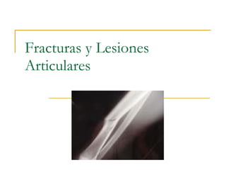 Fracturas y Lesiones Articulares 