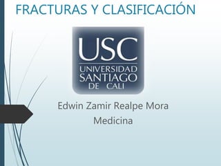 FRACTURAS Y CLASIFICACIÓN
Edwin Zamir Realpe Mora
Medicina
 