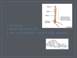 Transversal
Epífisis inferior del radio
Intra - articular (radio - cubital ó radio - carpiana)