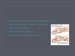Fractura de epífisis distal del radio con
desplazamiento cubital y palmar
Pala de jardinero
Mano en hiperflexión
Fractura de Colles invertida