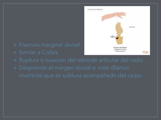 Fractura marginal dorsal
Similar a Colles
Ruptura o luxación del reborde articular del radio
Desprende el margen dorsal o volar (Barton
invertida) que se subluxa acompañado del carpo