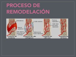 PROCESO DE
REMODELACIÓN