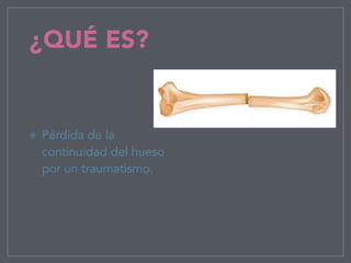 ¿QUÉ ES?
Pérdida de la
continuidad del hueso
por un traumatismo.