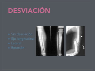 DESVIACIÓN
Sin desviación
Eje longitudinal
Lateral
Rotación
