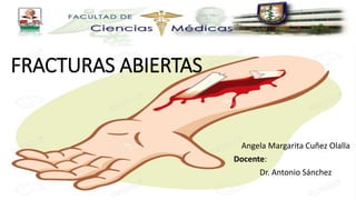 FRACTURAS ABIERTAS
Angela Margarita Cuñez Olalla
Docente:
Dr. Antonio Sánchez
 