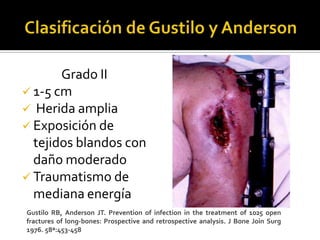 Grado II
 1-5 cm
 Herida amplia
 Exposición de
  tejidos blandos con
  daño moderado
 Traumatismo de
  mediana energía
Gustilo RB, Anderson JT. Prevention of infection in the treatment of 1025 open
fractures of long-bones: Prospective and retrospective analysis. J Bone Join Surg
1976. 58ª:453-458
 
