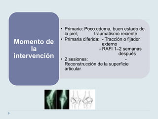 • Primaria: Poco edema, buen estado de 
la piel, traumatismo reciente 
• Primaria diferida: - Tracción o fijador 
externo 
- RAFI 1–2 semanas 
después 
• 2 sesiones: - 
Reconstrucción de la superficie 
articular 
Momento de 
la 
intervención 
 