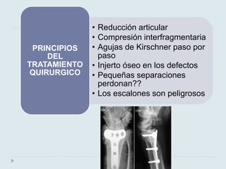 • Reducción articular 
• Compresión interfragmentaria 
• Agujas de Kirschner paso por 
paso 
• Injerto óseo en los defectos 
• Pequeñas separaciones 
perdonan?? 
• Los escalones son peligrosos 
PRINCIPIOS 
DEL 
TRATAMIENTO 
QUIRURGICO 
 