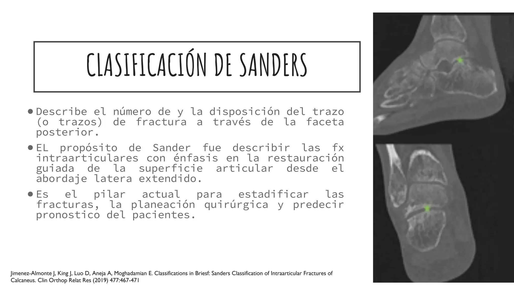 FRACTURAS CALCÁNEO -SANDERS-DR.ARTURO ZAMJDIO R3 TYO.pptx
