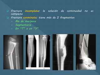  Fractura incompleta: la solución de continuidad no es
completa
 Fractura conminuta: tiene más de 2 fragmentos
 Ala de mariposa
 Segmentaria
 En “T” o en “Y”
 