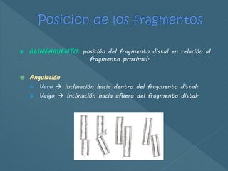 posición del fragmento distal en relación al
fragmento proximal.
 Angulación
 inclinación hacia dentro del fragmento distal.
 inclinación hacia afuera del fragmento distal.
 