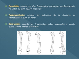 cuando los dos fragmentos contactan perfectamente
se habla de una buena aposición.
 Acabalgamiento: cuando los extremos de la fractura se
sobrepasan el uno al otro.
 Distracción: cuando los fragmentos están separados y existe
hueco entre ambos extremos.
 