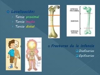 › Tercio proximal
› Tercio medio
› Tercio distal
Diafisarias
Epifisarias
 