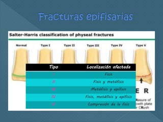  La las divide a cinco tipos según
la orientación del trayecto de la fractura con respecto a la
fisis y la metáfisis:
Tipo Localización afectada
I Fisis
II Fisis y metáfisis
III Metáfisis y epífisis
IV Fisis, metáfisis y epífisis
V Compresión de la fisis
 