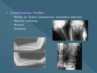  Complicaciones tardías:
› Atrofia de Sudeck (osteoporosis traumática dolorosa)
› Miosistis osificante
› Artrosis
› Sinóstosis
 
