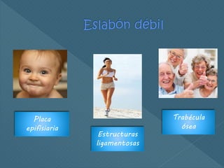 Placa
epifisiaria
Estructuras
ligamentosas
Trabécula
ósea
 