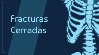 10cm
Fracturas
Cerradas
 