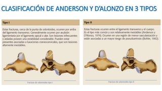 CLASIFICACIÓN DE ANDERSON Y D’ALONZO EN 3 TIPOS
 