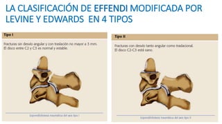 LA CLASIFICACIÓN DE EFFENDI MODIFICADA POR
LEVINE Y EDWARDS EN 4 TIPOS
 