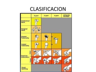CLASIFICACION
 