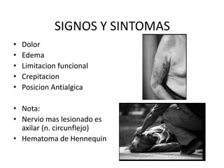 SIGNOS Y SINTOMAS
• Dolor
• Edema
• Limitacion funcional
• Crepitacion
• Posicion Antialgica
• Nota:
• Nervio mas lesionado es
axilar (n. circunflejo)
• Hematoma de Hennequin
 