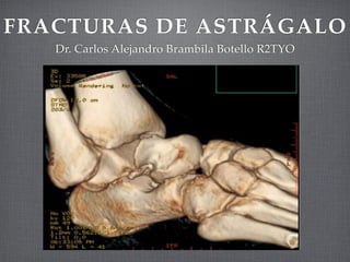 FRACTURAS DE ASTRÁGALO
   Dr. Carlos Alejandro Brambila Botello R2TYO
 