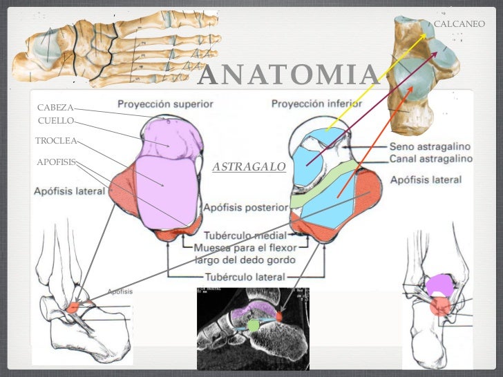 Fracturas del Astragalo