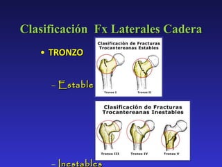 Clasificación  Fx Laterales Cadera TRONZO Estables  Inestables  