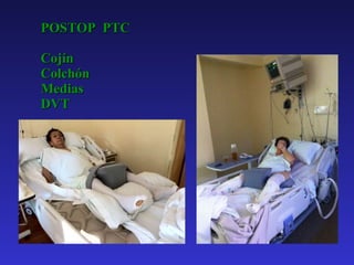 POSTOP  PTC Cojín Colchón Medias DVT 