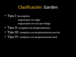 Clasificación:  Garden Tipo I : incompleta engranadas en valgo engranadas en varo por fatiga Tipo II:  completa sin desplazamiento Tipo III:  completa con desplazamiento parcial Tipo IV:  completa con desplazamiento total 