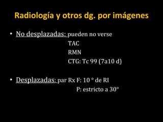 Radiología y otros dg. por imágenes No desplazadas:  pueden no verse TAC RMN CTG: Tc 99 (7a10 d) Desplazadas :  par Rx F: 10 ° de RI P: estricto a 30° 