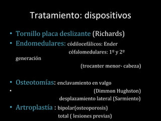 Tratamiento: dispositivos Tornillo placa deslizante  (Richards) Endomedulares:  códilocefálicos: Ender céfalomedulares: 1º y 2º generación (trocanter menor- cabeza) Osteotomías :  enclavamiento en valgo  (Dimmon Hughston) desplazamiento lateral (Sarmiento) Artroplastía  :  bipolar(osteoporosis) total ( lesiones previas) 