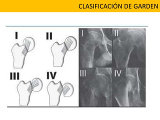 CLASIFICACIÓN DE GARDEN
 