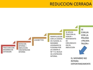 REDUCCION CERRADA
TRACCION CON
MIEMBRO EN
EXTENSION
ROTACION
INTERNA +
ABDUCCION
CON ROTACION
INTERNA
LEADBETTER:
MANIPULACION
CON LA CADERA
EN FLEXION, EL
MIEMBRO
LESIONADO SE
FLEXIONA POR
LA CADERA A
90° Y EL MUSLO
VA A ROTACION
INTERNA.
SE APLICA
TRACCION AL
FEMUR +
MOVIMIENTO
DE
CIRCUNDUCCI
ON EN
ABDUCCION
SE
EVALUA
CON LA
PRUEBA
«PALMA-
TALON»
EL MIEMBRO NO
ROTARA
EXPONTANEAMENTE
 