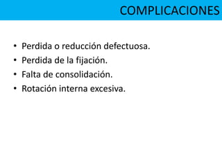 • Perdida o reducción defectuosa.
• Perdida de la fijación.
• Falta de consolidación.
• Rotación interna excesiva.
COMPLICACIONES
 