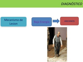 Mecanismo de
Lesion
Baja Energía ANCIANOS
DIAGNÓSTICO
 