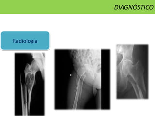 Radiología
DIAGNÓSTICO
 