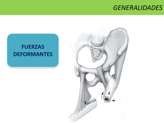 FUERZAS
DEFORMANTES
GENERALIDADES
 