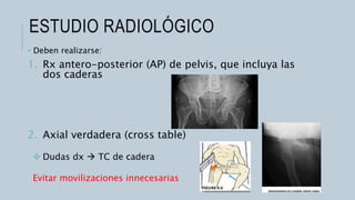 Fracturas de cadera.pptx
