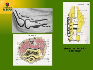 NERVIO  INTEROSEO  POSTERIOR 