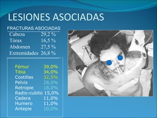 LESIONES ASOCIADAS Fémur   39,0% Tibia   34,0% Costillas   32,5%   Pelvis   28,0% Retropie   18,0% Radio-cubito 15,0% Cadera    11,0% Humero   11,0% Antepie   10,0% FRACTURAS ASOCIADAS ____________________ ____________________ Cabeza 29,2 % Tórax 16,5 % Abdomen 27,5 % Extremidades 26,8 % 